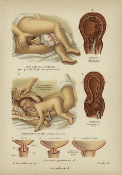 Childbirth by German School