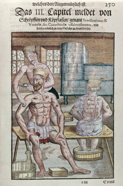 Cupping, from Ophthalmodouleia by Georg Bartisch published in Dresden in 1583 by German School