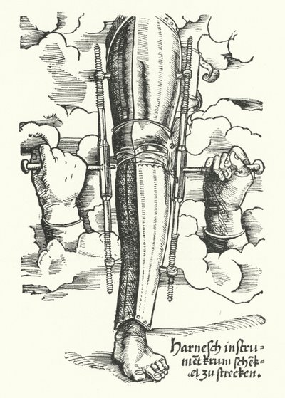 Device to Straighten a Wounded Leg by German School