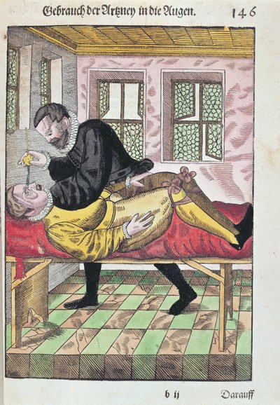 Eye Operation, from Ophthalmodouleia by Georg Bartisch published in Dresden in 1583 by German School