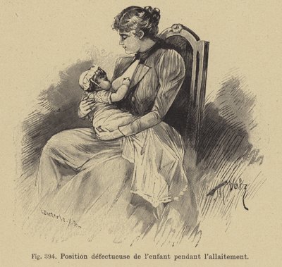 Incorrect Position of a Baby During Breastfeeding by German School