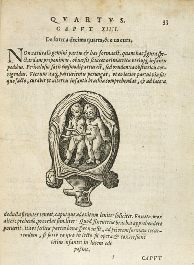 Non-Identical Twins in the Womb, Illustration from Chapter 14, Book 4 of On the Conception and Growth of Man by Rueff, 1587 by German School