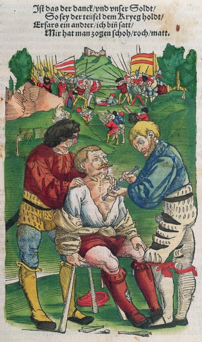 Removing an Arrow, Illustration from Feldtbuch der Wundartzney by Hans von Gersdorff by German School