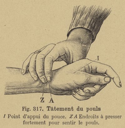 Taking the Pulse at the Wrist by German School