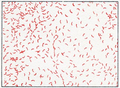 Bacterium Vibrio cholerae by German School