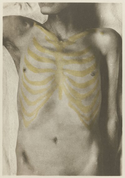 Anatomical Photo of a Male Corpse: 