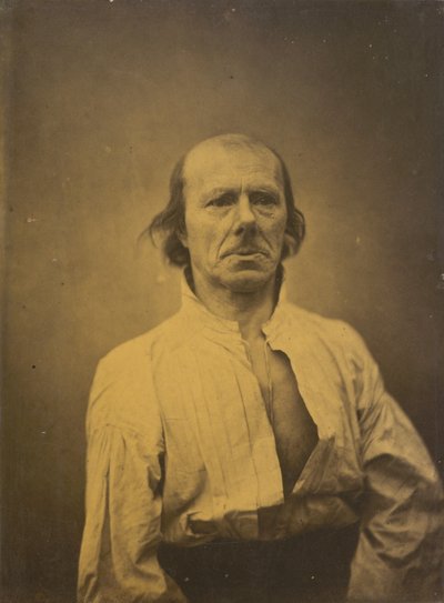 Face in Repose, 1854-1856, Printed 1862 by Guillaume-Benjamin-Armand Duchenne de Boulogne