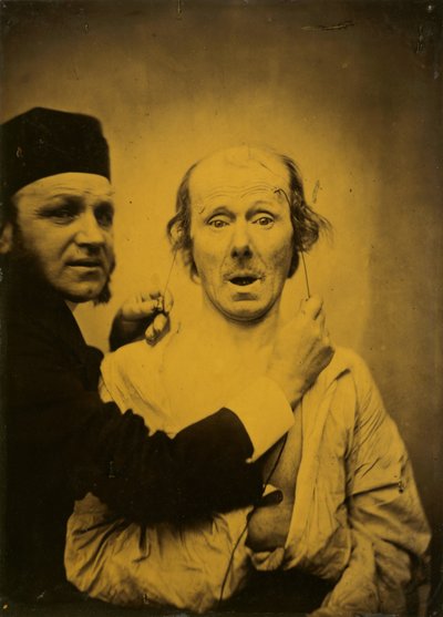 Surprise, 1854-1855, Printed 1862 by Guillaume-Benjamin-Armand Duchenne de Boulogne