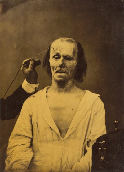 A Relaxed Face (left); Profound Attention (right) by Guillaume Benjamin Amant Duchenne