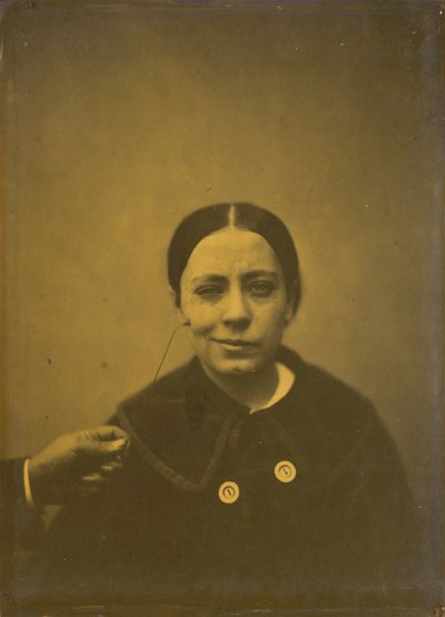 Slight Lowering of the Angle of the Mouth Due to Depression (left); False Laughter (right) by Guillaume Benjamin Amant Duchenne