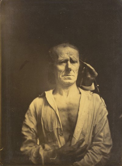 Spasm of m. corrugator supercilii under very strong light (left); A relaxed face (photographed in full sunshine) (right) by Guillaume Benjamin Amant Duchenne