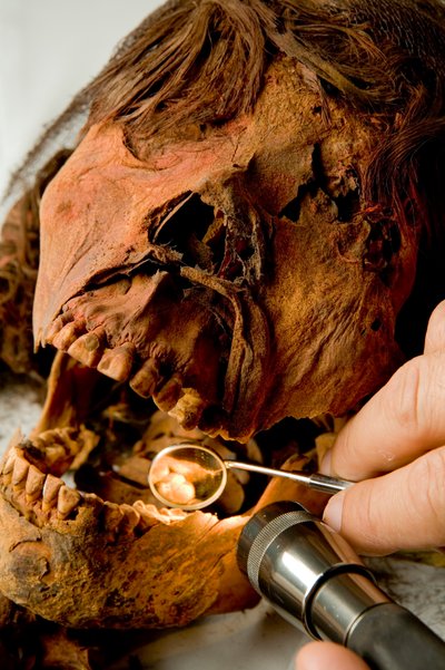 Dr. John Varano examines the teeth of the mummy by Ira Block