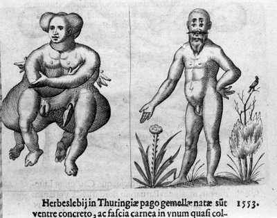 Different types of human monsters. Engraving from “De monstrorum natura, causis et differentiis” by Fortunio Liceti (1577-1656), Italian scientist. 1646 by Italian School