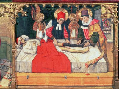 SS. Cosmas and Damian Graft the Leg of an Ethiopian Man onto the Stump of Deacon Justinian by Jaume Huguet