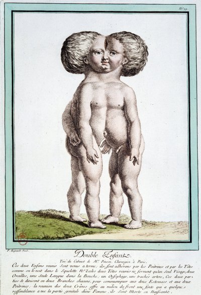 Siamese Children - in 