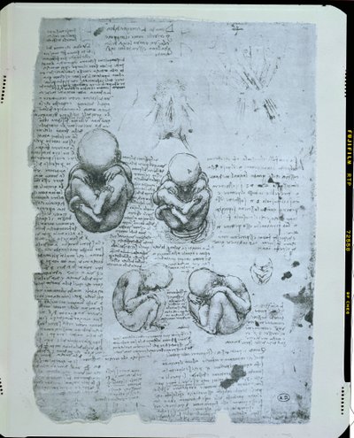 Five Views of a Foetus in the Womb, Facsimile Copy by Leonardo da Vinci