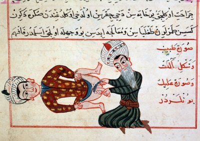 Emasculation of a hermaphoditis by Ottoman School