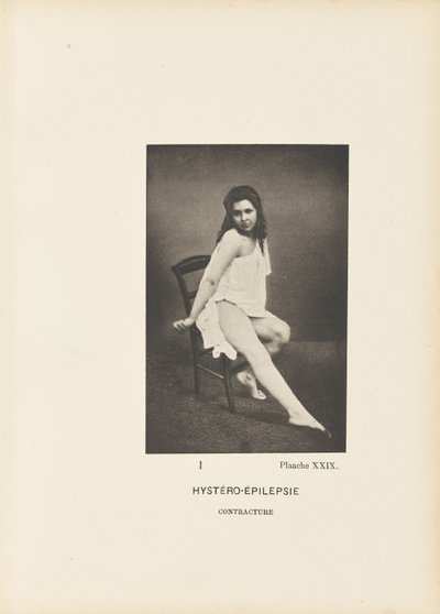 Hystero-Epilepsy Contracture by Paul Marie Léon Regnard