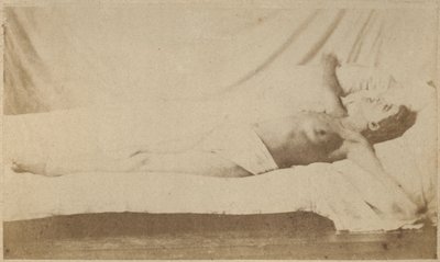 Hysterical Epilepsy, Attack, Crucifixion, Plate VI from 