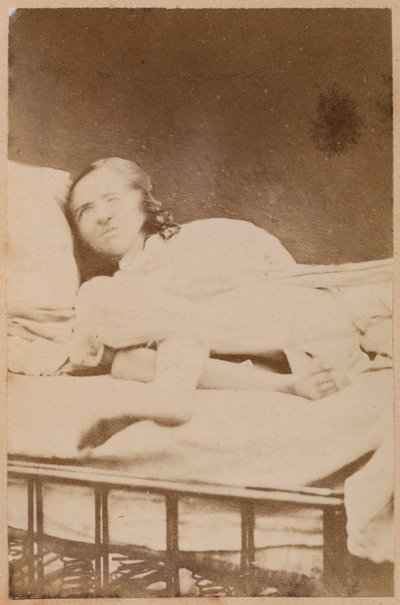Hysterical epilepsy, contortions, plate XXXVIII from 