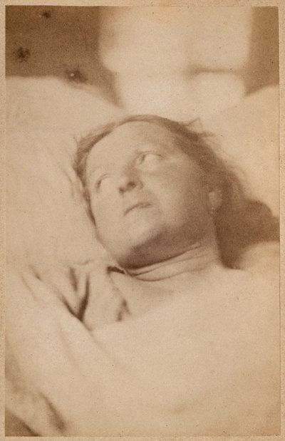 Hysterical epilepsy, crucifixion, head attitude (plate VII from 