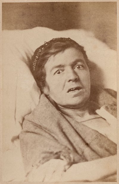 Hysterical epilepsy, face contraction, plate VIII from 