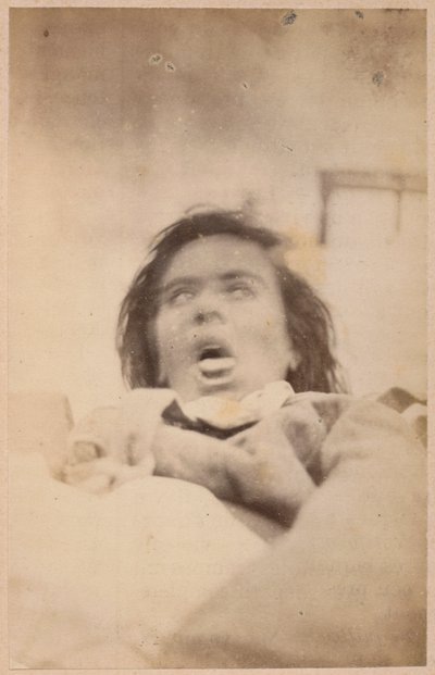 Hysterical epilepsy, hallucinations, anguish, plate XXIX from 