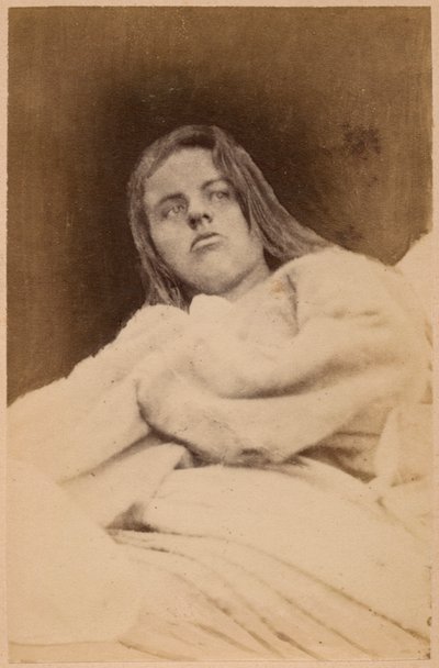 Hysterical epilepsy, hallucinations, disdain, plate XXXI from 