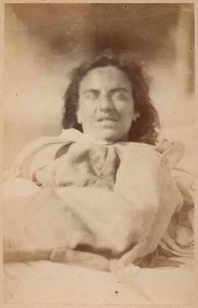 Hysterical epilepsy, hallucinations, irony, plate XXXII from 