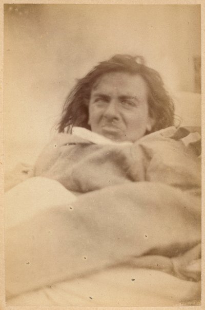 Hysterical epilepsy, hallucinations, repugnance, plate XXXV from 
