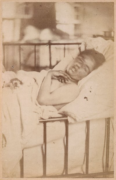 Hysterical epilepsy, permanent contraction, plate XXVIII from 