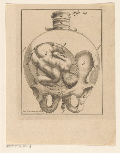 Fetus in Womb (Medical Prints on Pregnancy and Birth) by Philibert Bouttats (II)