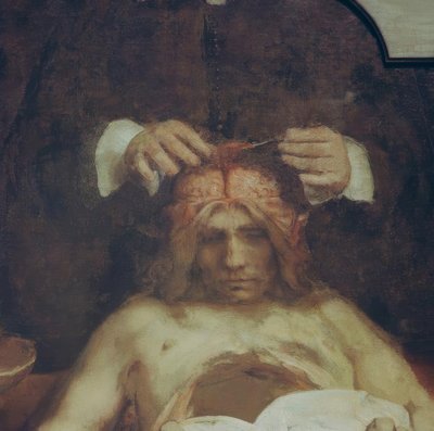 The Anatomy Lesson of Dr. Johan Deijman by Rembrandt van Rijn