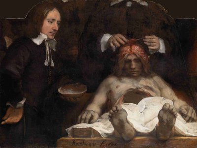 The Anatomy Lesson of Dr. Jan Deijman, 1656 by Rembrandt van Rijn