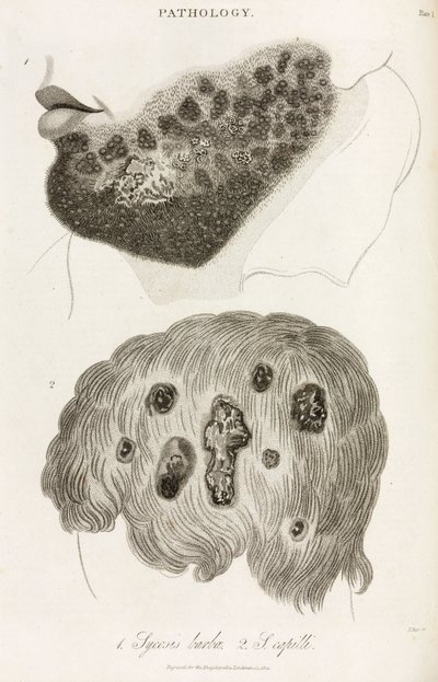 Skin Diseases by John Pardon