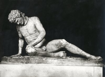 Dying Gaul, Copy of a Greek Original of c.230-220 BC by Epigonos by Roman Roman