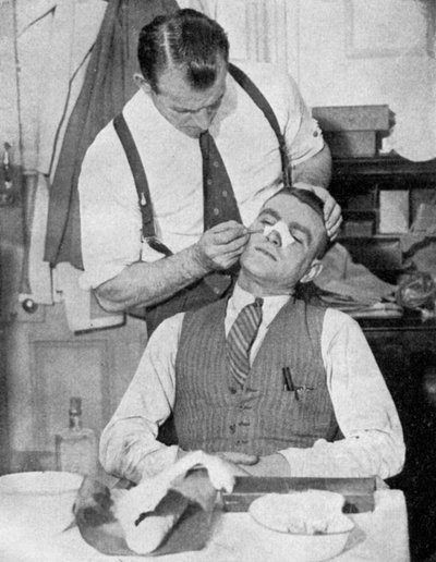 England Captain Eddie Hapgood Receives Treatment for a Broken Nose After a Match with Italy by Topical Press Agency