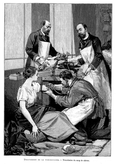 A tuberculosis patient being given a transfusion of goat