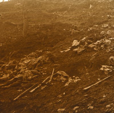 After the Attack, Les Éparges, Northern France, 1915 by Unbekannt