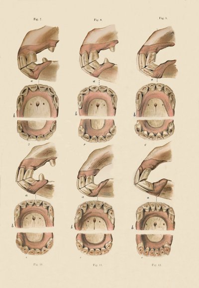 Description of Plate Showing the Age, As Indicated By The Teeth by Unbekannt