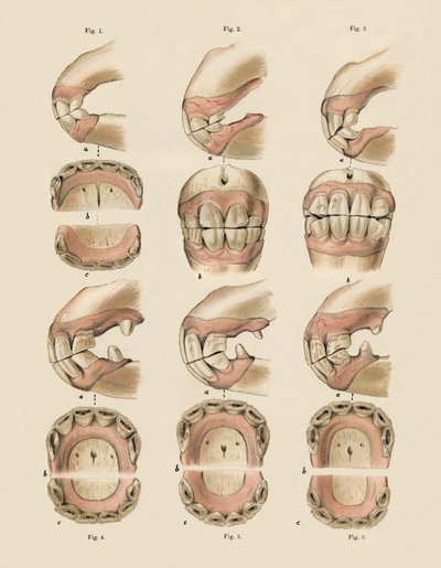 Description of Plate Showing the Age, as Indicated by the Teeth by Unbekannt