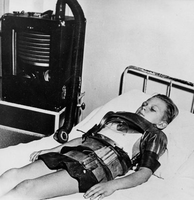 Eleven-Year-Old Boy in an Iron Lung, Beaujon Hospital, Paris by Unbekannt
