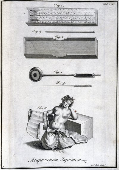 Acupuncture Needles and Their Application, c. 1690, Engraving by G. van der Gucht by Unbekannt