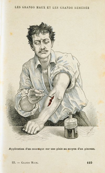 Painting a Wound with an Antiseptic Solution by Unbekannt