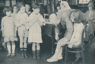 Testing the Patella Reflex for Indication of Nervous Disease by Unbekannt
