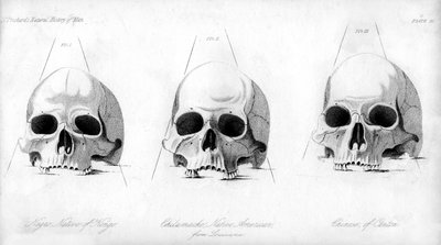 Three types of human skull, 1848 by Unbekannt
