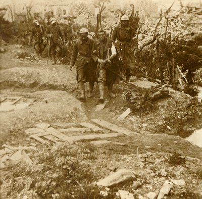 Wounded French Infantrymen Arriving at Chateau d