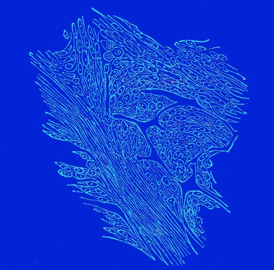 Crossing section of fibro-nucleated tumors by Unbekannter Künstler
