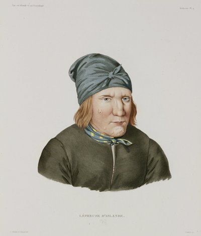 Diseases, Leprosy (Female Leper, Iceland, Early 19th Century) by Unbekannt