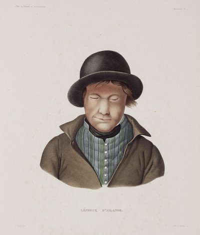 Leprosy Male leper, Iceland, early 19th century by Unbekannt
